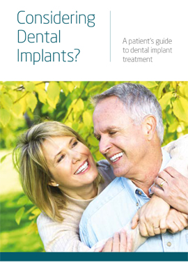 Considering dental implants v2021