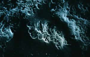 Leucite crystals