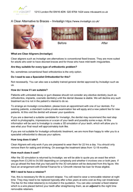 Orthodontic Aligners
