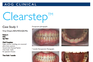 Clearstep