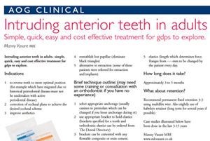 Intruding Anterior Teeth in Adults